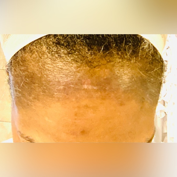 Brighton soap for dark area this soup is so amazing Lemon/ vitamin E Tur… - Picture 3 of 4